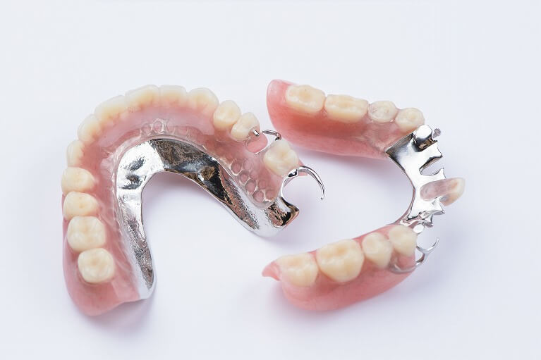 快適な入れ歯づくりには、完成後の微調整がとても重要です