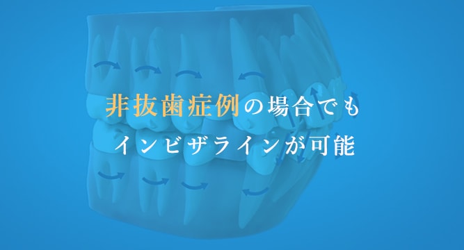 非抜歯症例の場合でもインビザラインが可能