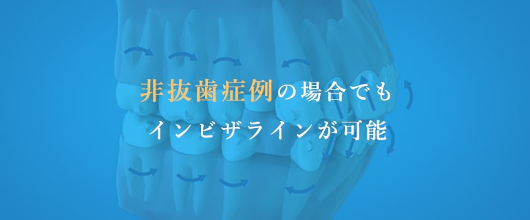 非抜歯症例の場合でもインビザラインが可能