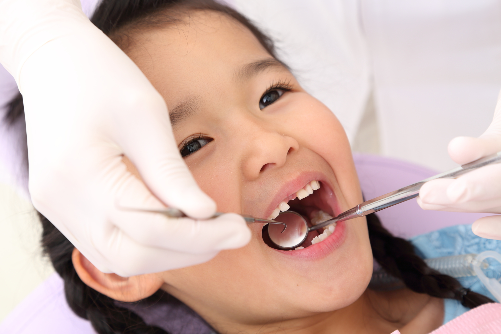 子どもの出っ歯(上顎前突)矯正治療の開始時期