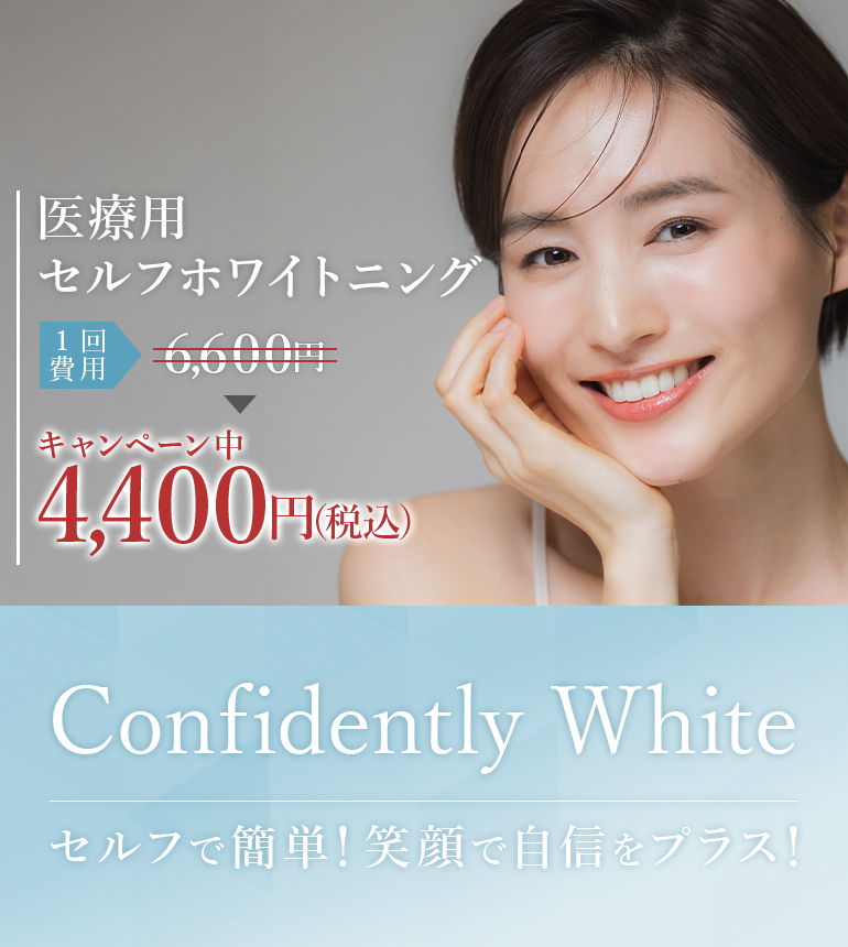 医療用ホワイトニング　１回費用6,600円がキャンペーン中4,400円(税込)　Confidently White セルフで簡単！笑顔で自信をプラス！